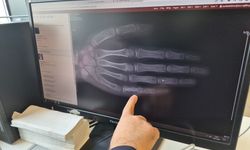 Eskişehir'de her ay 5 ila 7 çocuğa kanser tanısı konuluyor