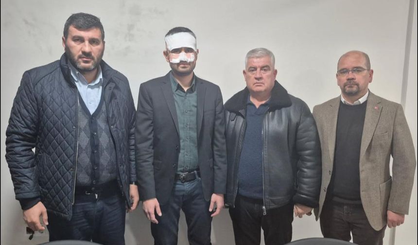 Öğretmen Müdür Yardımcısının Yüzüne Sıcak Çay Döktü